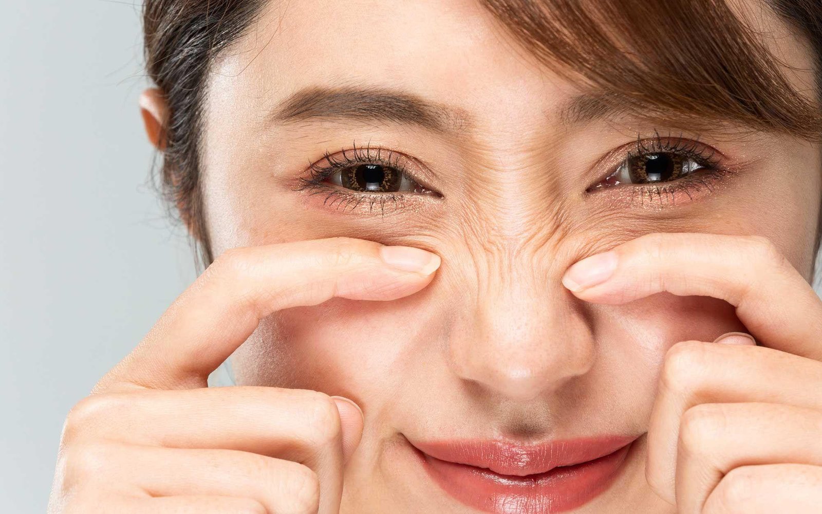 Botox for bunny lines on the nose, Nottingham MD
