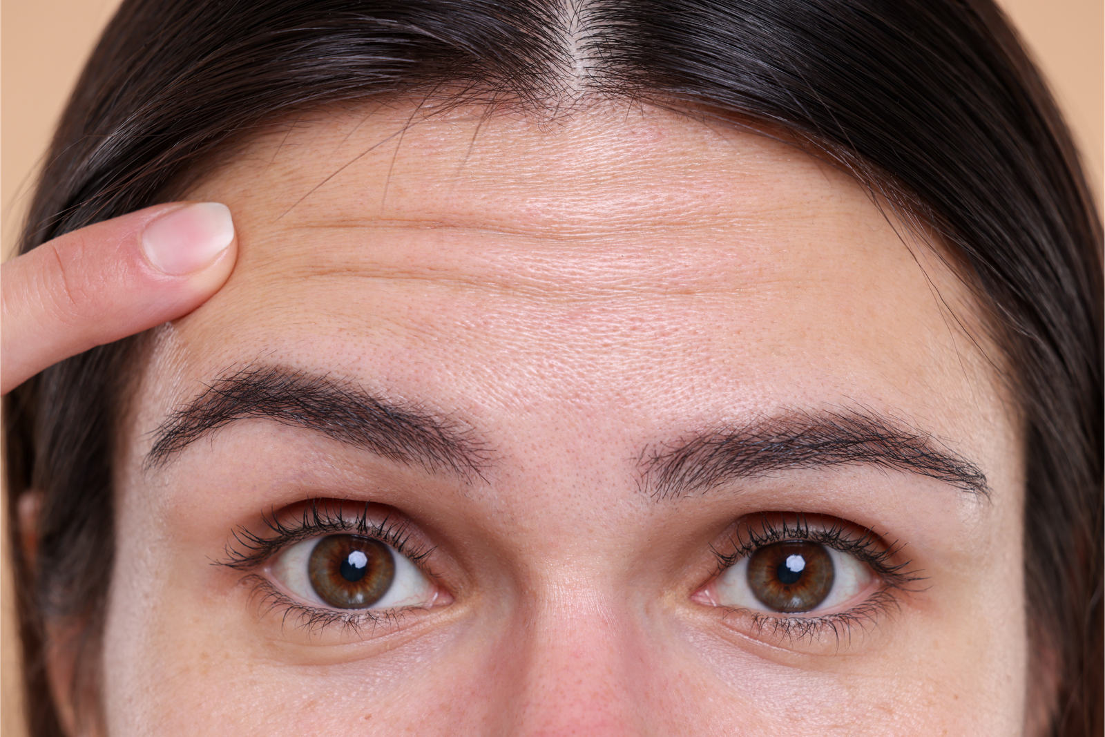 Botox for forehead lines at Marlana Aesthetics, Nottingham MD