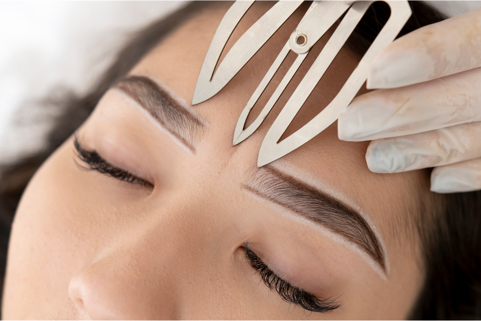 Botox brow lift for more open eyes, Nottingham MD