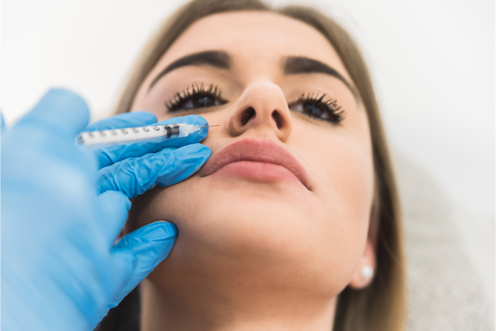Botox for a gummy smile at Marlana Aesthetics, Nottingham MD