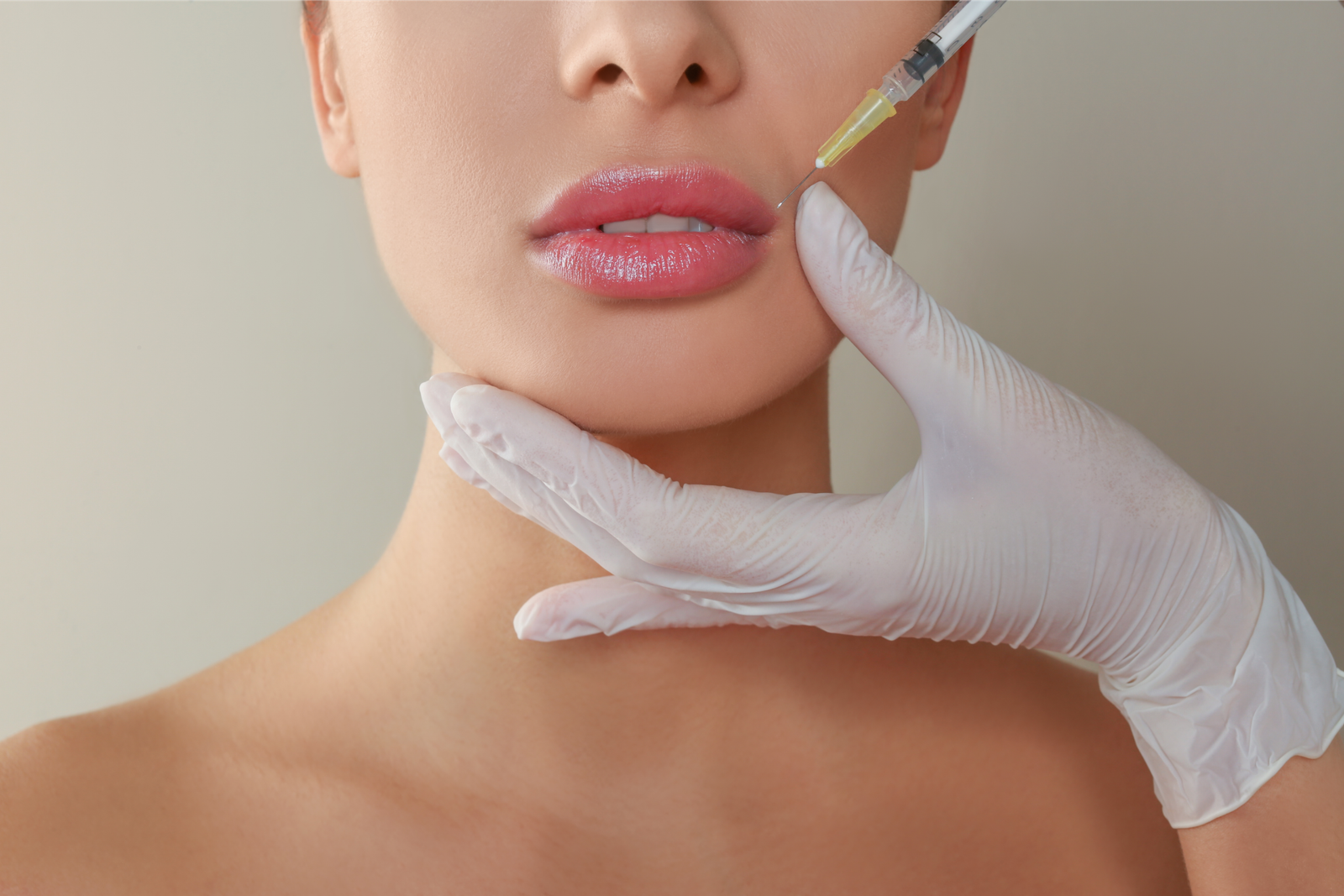 Lip flip with Botox for a fuller-looking upper lip, Nottingham MD
