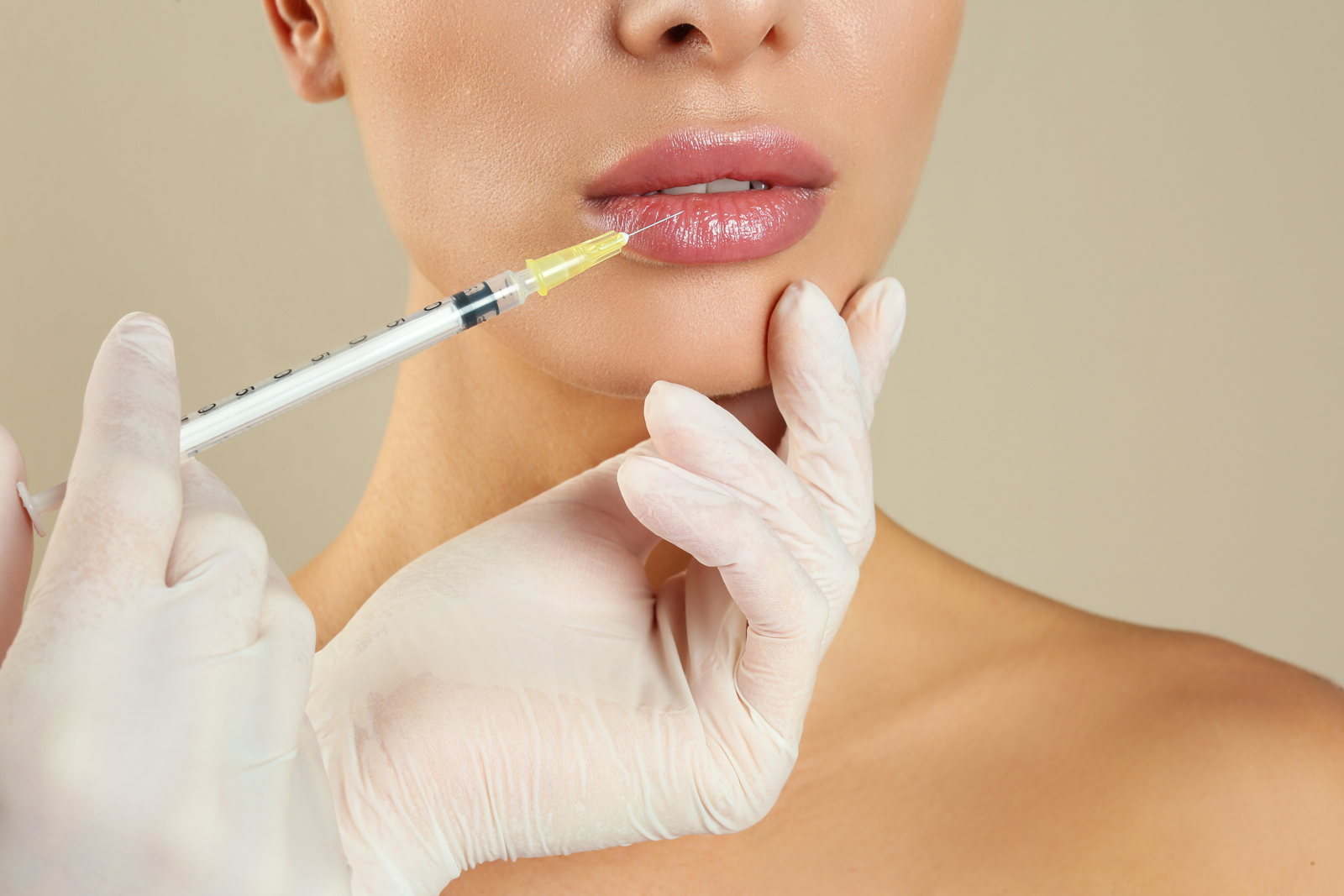 Lower face filler for chin, jawline and marionette lines, Nottingham MD