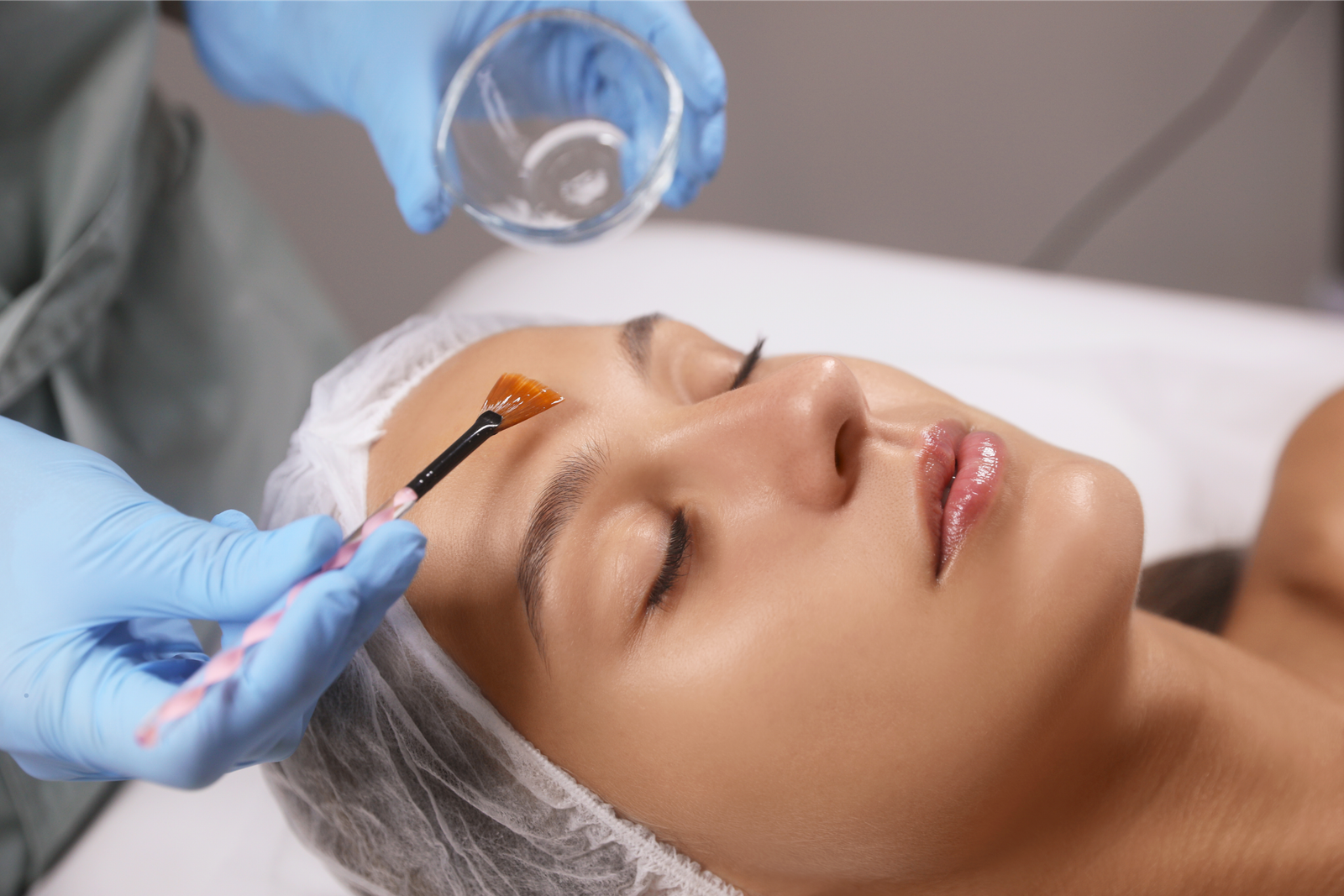 Medical-grade chemical peel for smoother, brighter skin, Nottingham MD