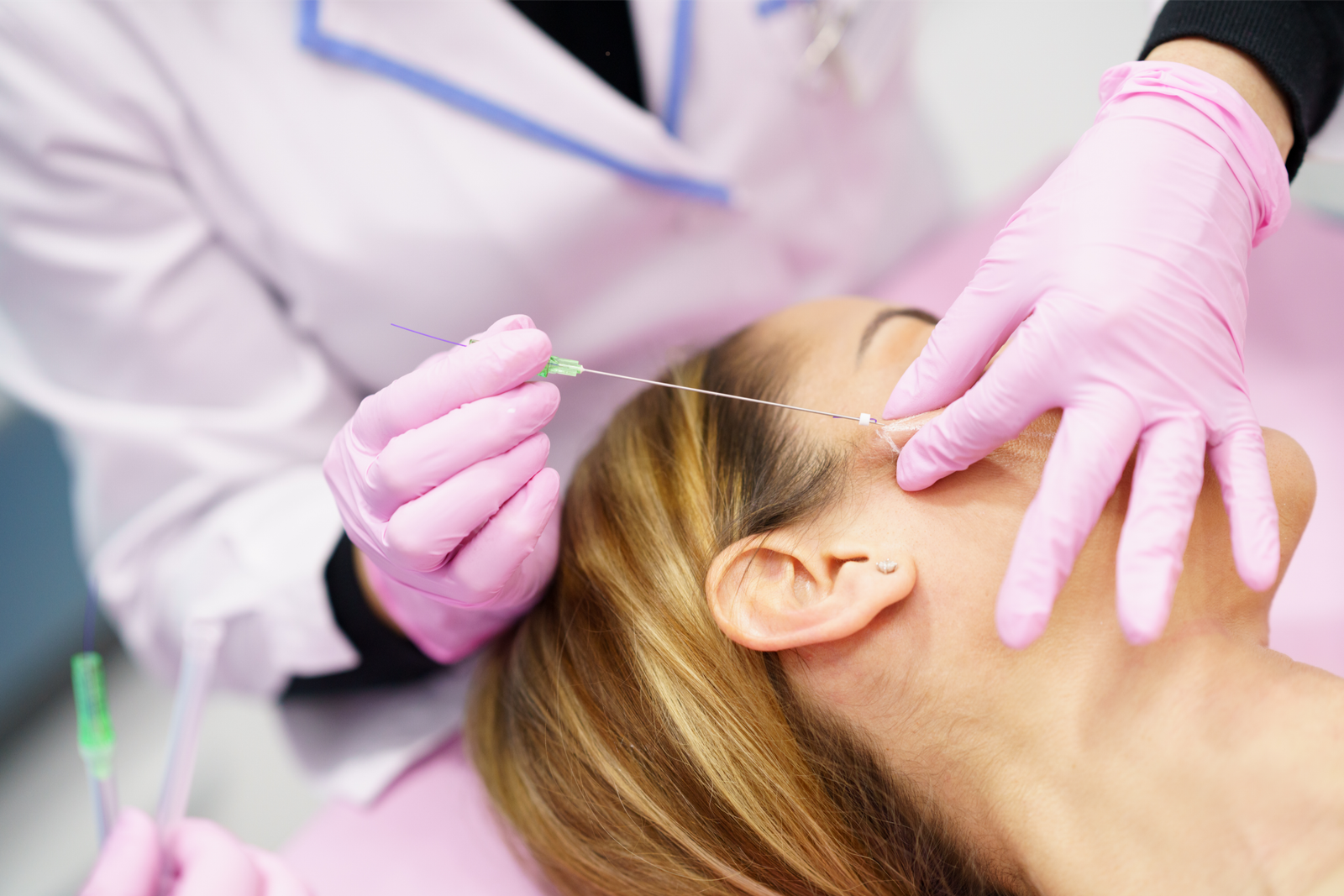 PDO smooth threads to firm and tighten skin, Nottingham MD